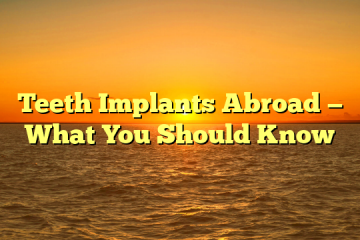 Teeth Implants Abroad — What You Should Know